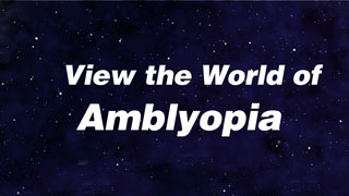 Amblyopia